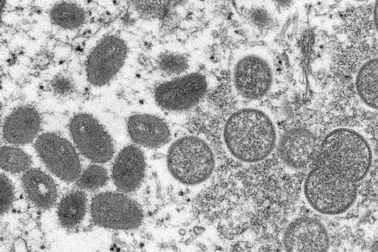 미국 질병통제예방센터가 공개한 원숭이두창 바이러스 ⓒ뉴시스